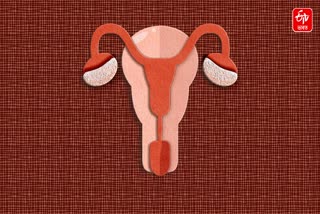 Vaginal bleeding can be a sign of ovarian cyst, identify it with these symptoms