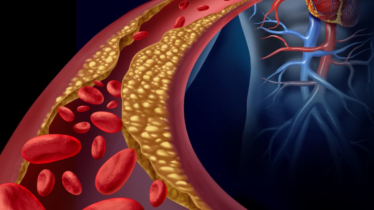 The tongue appears to be a sign of cholesterol