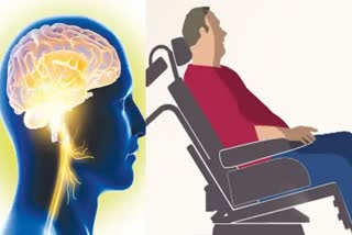 Prevent Brain Stroke With Lifestyle Changes