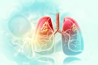 Warning_Signs_of_Lung_Cancer