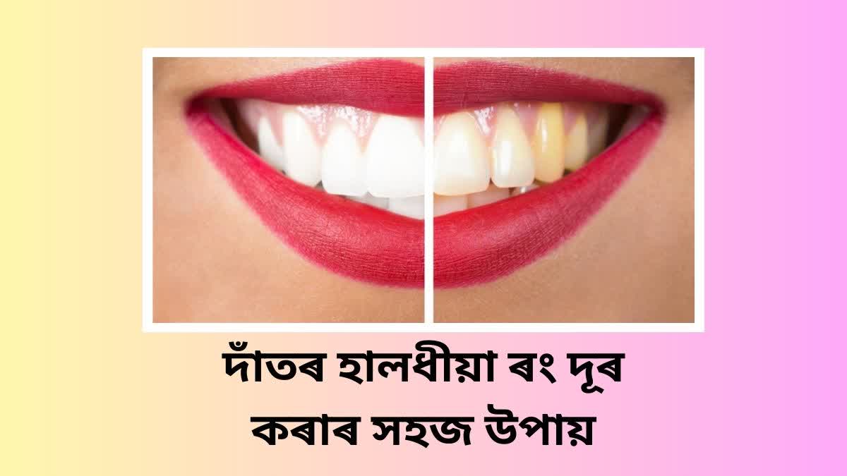 Clean your teeth by mixing these three things 3 times a week, your teeth will always shine like pearls