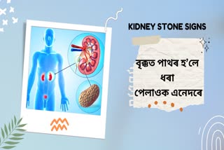 These symptoms seen in the body can be a sign of kidney stone