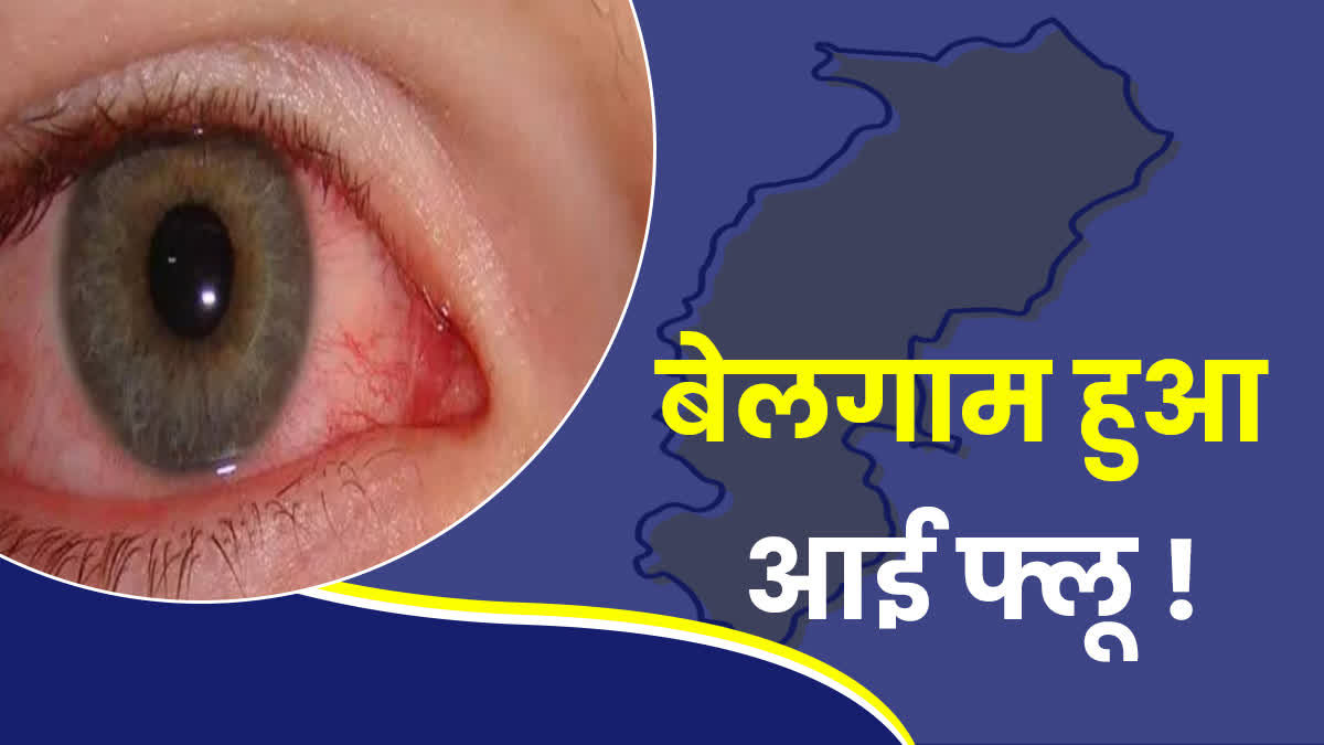 Eye Flu havoc in Chhattisgarh