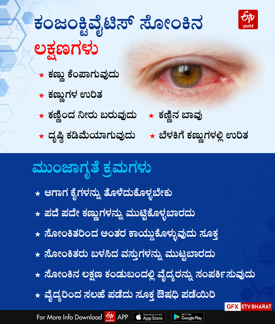 madras-eye-virus-spreading-among-children-in-davangere-district