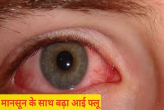 Conjunctivitis spread in many districts of MP