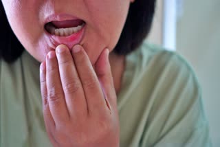 Home Remedies For Mouth Ulcers