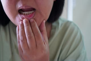 Mouth Ulcers