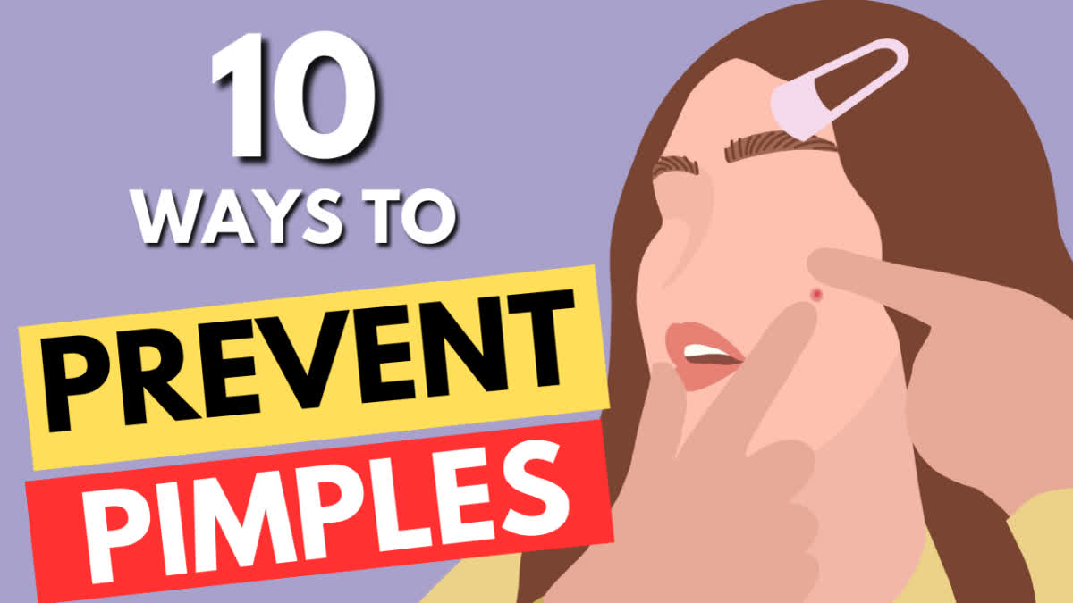 Ten ways to prevent pimples