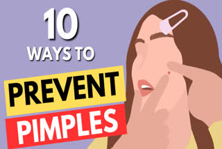 Ten ways to prevent pimples