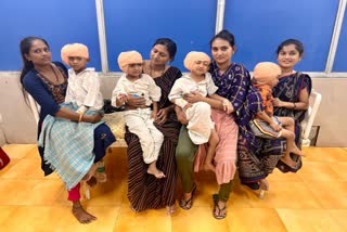 Surat News : સુરત સિવિલ હોસ્પિટલમાં જન્મથી મૂકબધિર બાળકોની  ‘ કોક્લિયર ઈમ્પ્લાન્ટ ’ની સફળ સર્જરી, 4 પરિવારની વિપદા ટળી