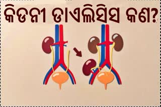 kidney dialysis