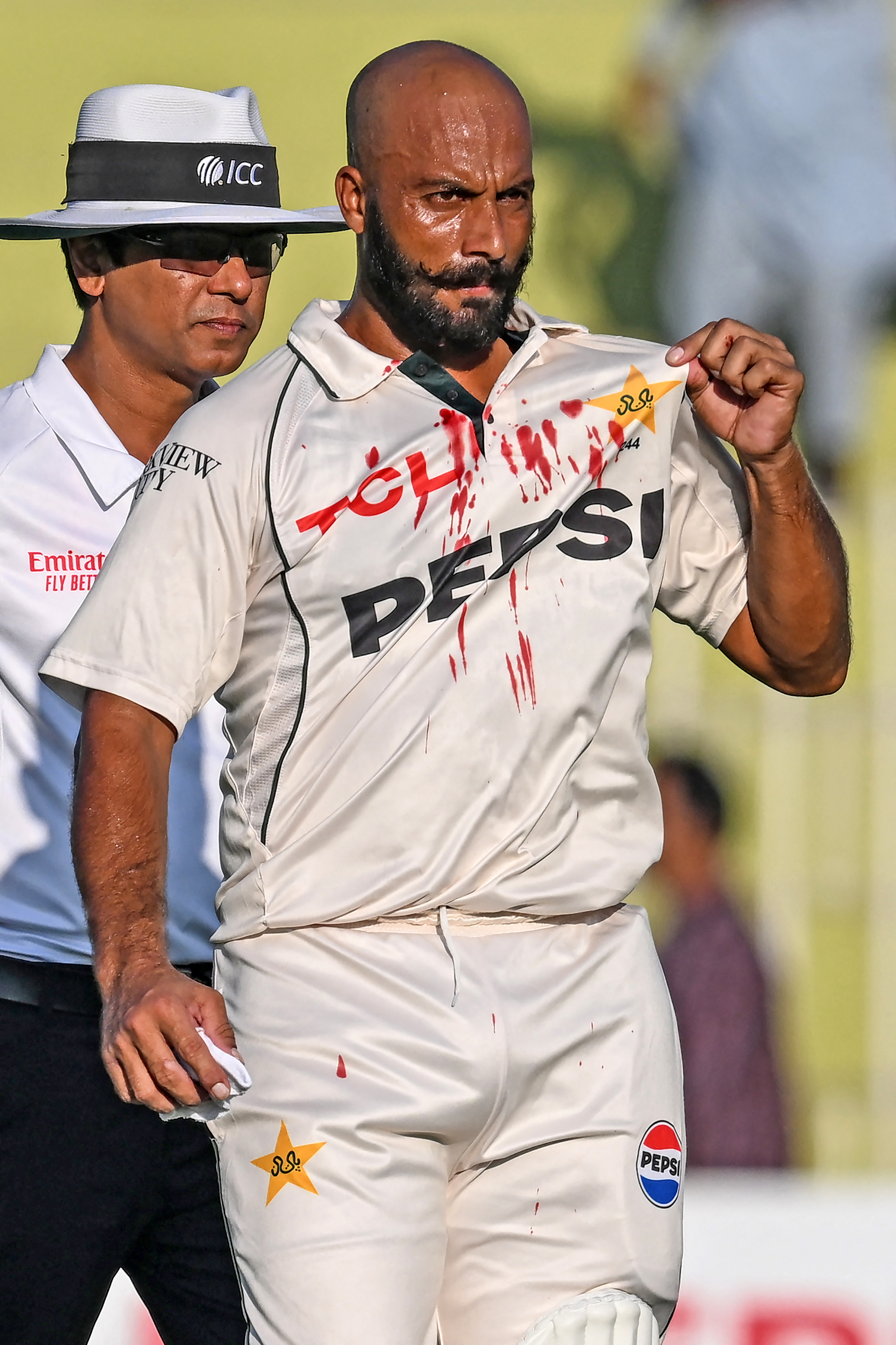 Sajid Khan Blood on Jersey