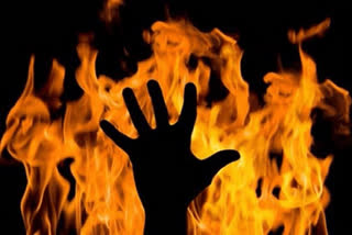 Woman set on fire for dowry in UP, dies at hospital