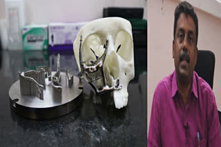 iit madras invented facial implants for people suffering from black fungus