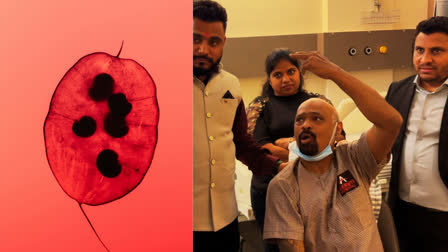 Blood clots are forming in former cricketer Vinod Kambli's brain