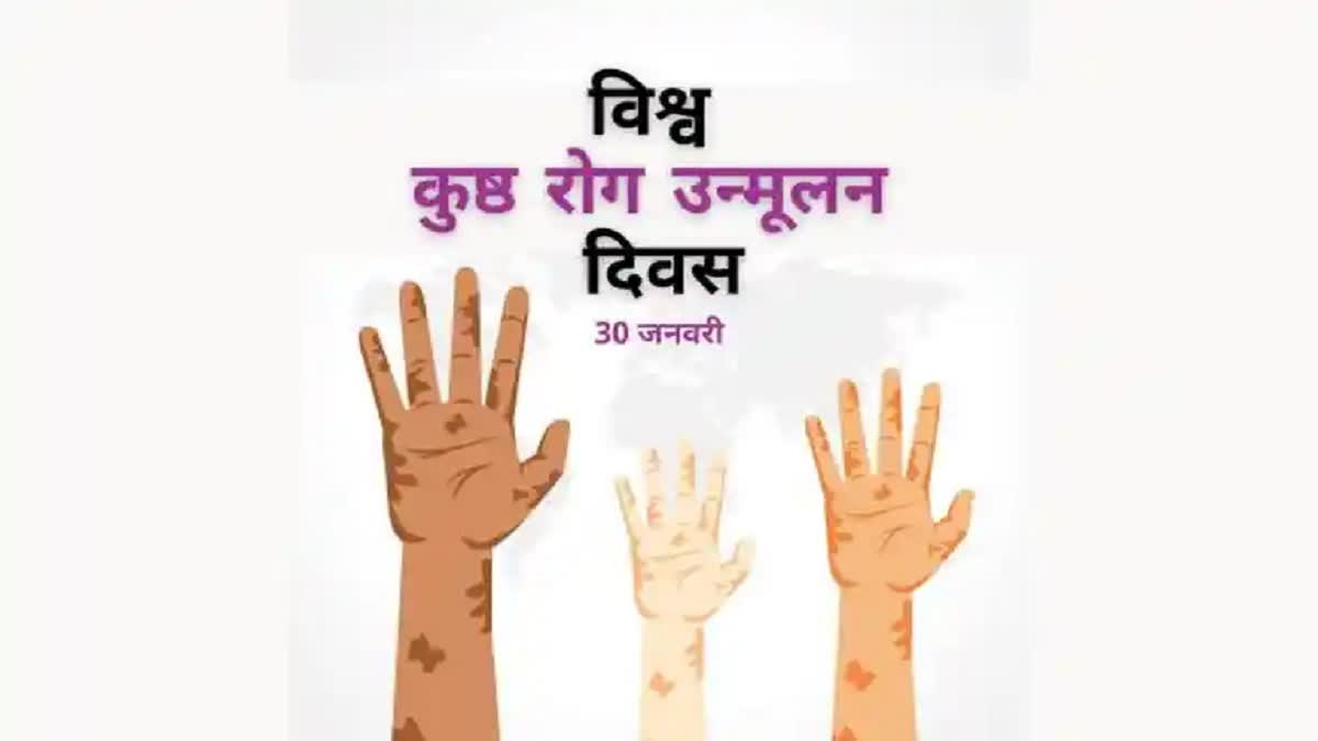 World Leprosy Day 2024