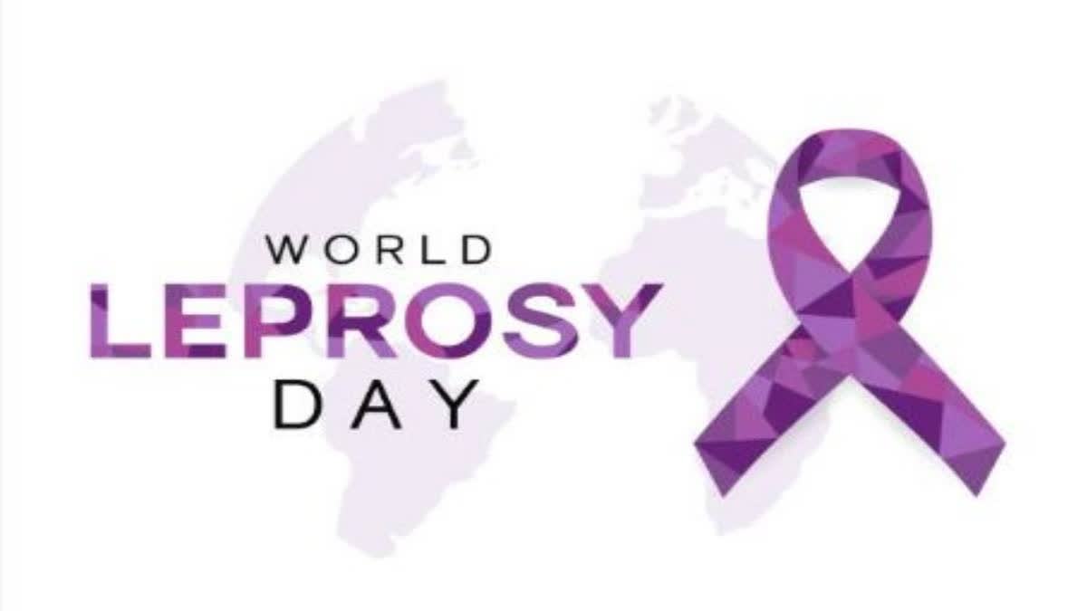 World Leprosy Day 2024 'Beat Leprosy'