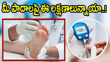 High Blood Sugar Warning Signs on Feet