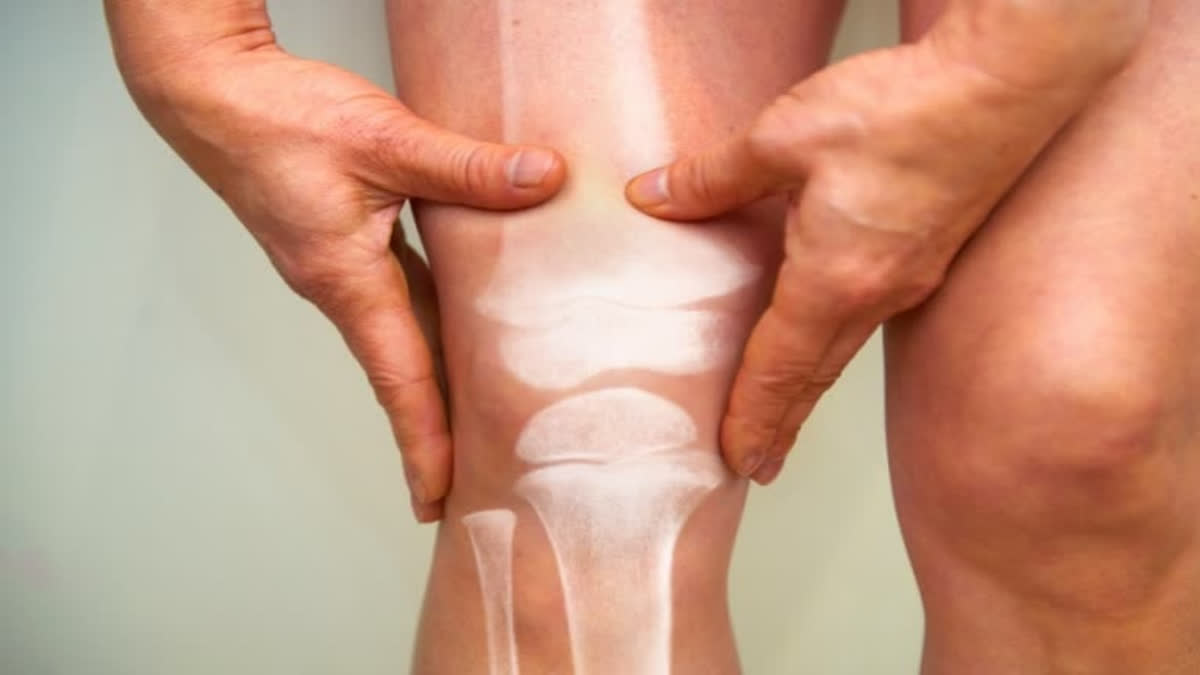 predicted knee osteoarthritis via a blood test at least eight years  before