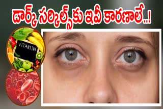 Reasons for Dark Circles