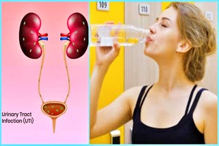 URINARY INFECTION KIDNEY STONES