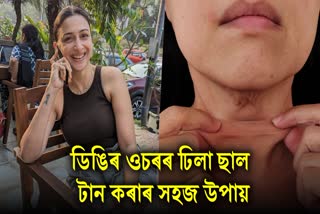How the loose skin near the neck can be made tight