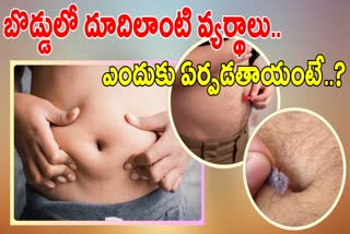 Reasons For Wastage Formed in Navel
