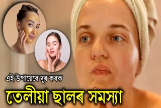 home remedies for oily skin and black spots and how to avoid black spots and oily skin