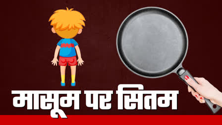 SHAHDOL CHILD BURNT WITH HOT PAN