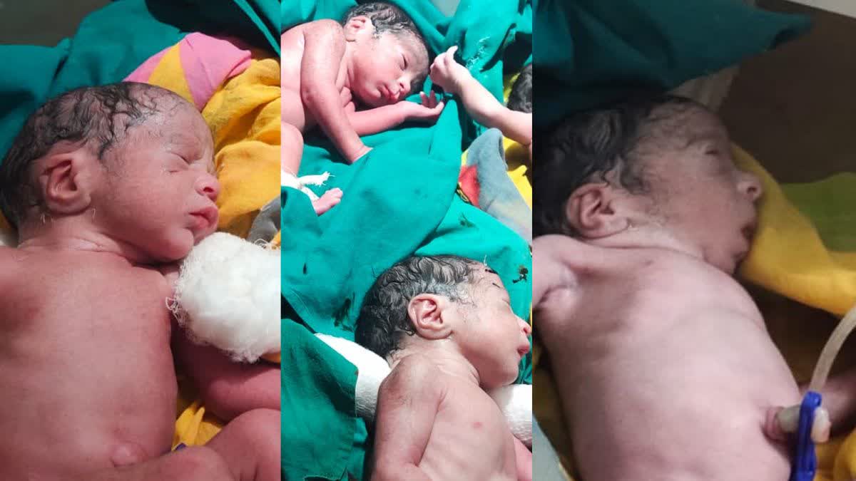 Rajasthan : टोंक में महिला ने एक साथ चार बच्चों को दिया जन्म, सभी  स्वस्थ्य...डॉक्टर ने बताया रेयर केस, rajasthan -woman-give-birth-to-quadruplets-in-tonk-district
