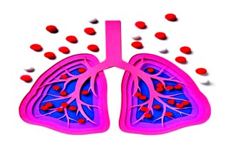 IIT Kanpur developed  A Continuous Lung Health Monitoring System with the help of IIT Kharagpur and IIIT Raipur