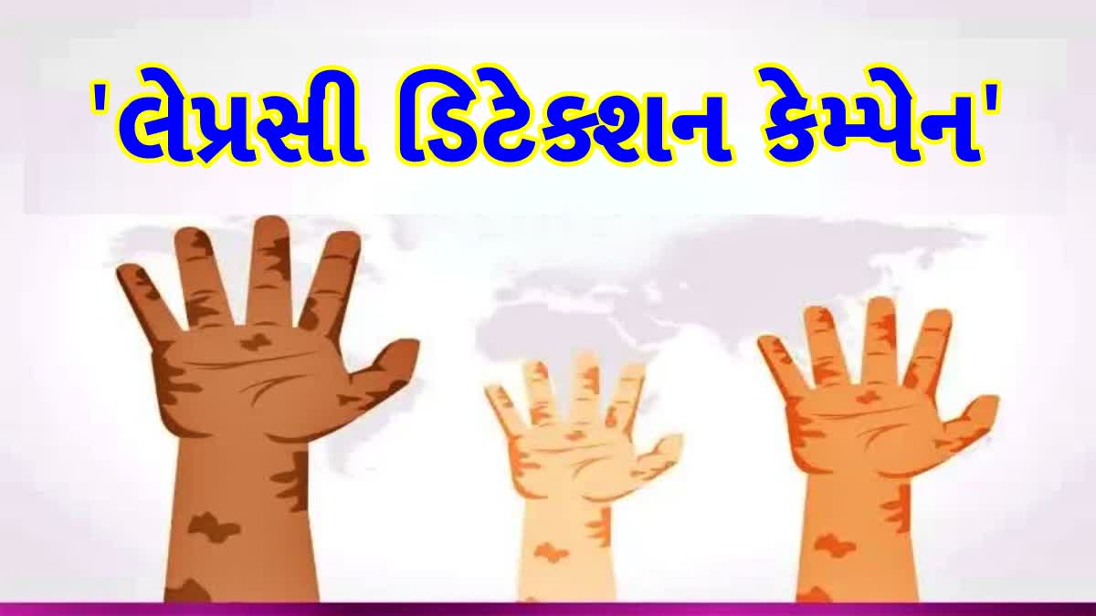 1થી 19 જાન્યુઆરી, 2024 સુધી 'લેપ્રસી ડિટેક્શન કેમ્પેન' યોજાશે