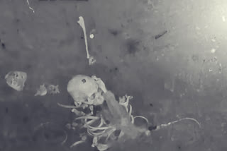 Human skeleton found near sirkazhi image