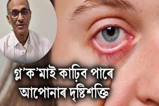 eye glaucoma