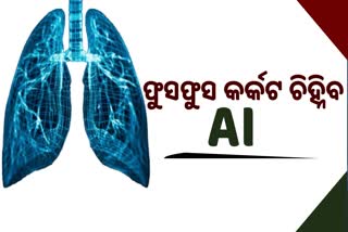 Lung Cancer Detection By AI