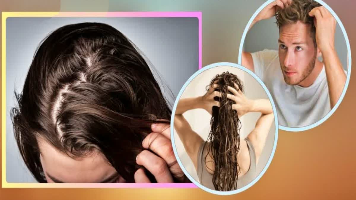 BEST TIPS TO PREVENT GREASY HAIR  HOW TO PREVENT GREASY HAIR  HAIR CARE TIPS  EASY WAYS TO GET RID OF GREASY HAIR