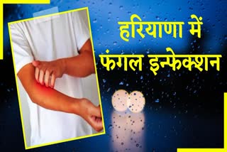 Haryana Fungal Infection Cases