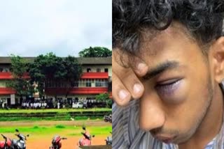 Ragging  kozhikode mes ragging  students suspended  mes college ragging  എംഇഎസ് കോളജിലെ റാഗിങ്ങ്  റാഗിങ്  വിദ്യാർഥികളെ സസ്‌പെൻഡ് ചെയ്‌തു  കോഴിക്കോട് റാഗിങ്  students expelled  students expelled from the MES college