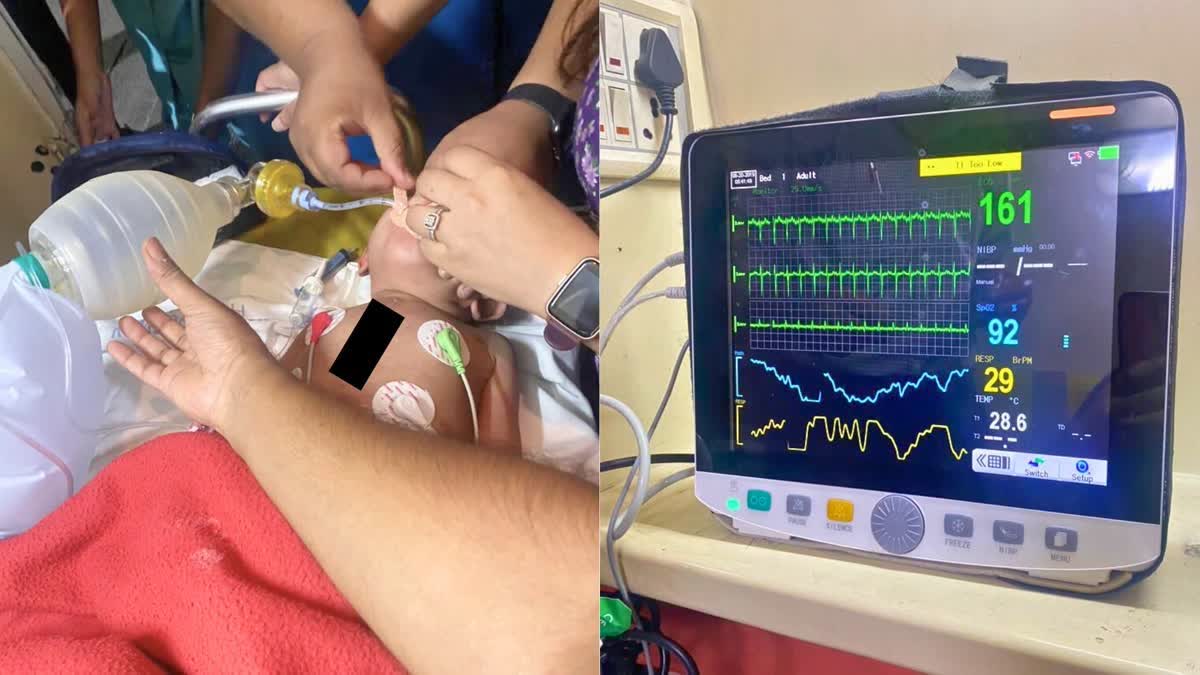 Doctors onboard save life of baby  AIIMS Doctors  AIIMS  AIIMS Doctors saves life of baby  Doctors onboard  Air Vistara  Intracardiac Repair  Bengaluru to Delhi  Cardiopulmonary Resuscitation  Intracardiac Repair  Cardiopulmonary Resuscitation  AED  വിമാനത്തില്‍ വച്ച് ശ്വാസം നിലച്ച്  ശ്വാസം നിലച്ച് രണ്ടുവയസുകാരി  രണ്ടുവയസുകാരി  ജീവന്‍ രക്ഷിച്ച് യാത്രക്കാരായ 5 ഡോക്‌ടര്‍മാര്‍  ഡോക്‌ടര്‍മാര്‍  എയിംസ്  ഇൻട്രാ കാർഡിയാക്ക് റിപ്പയർ  വിസ്‌താര  സിപിആര്‍