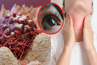 Remove Brain Tumor Through Eyelid