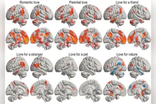 In which part of the brain does the feeling of love occur