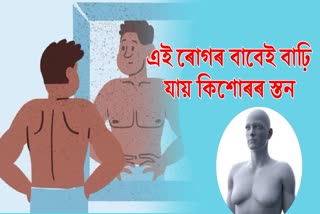 Gynecomastia condition among teenagers, what it is, cause, diagnosis and treatment