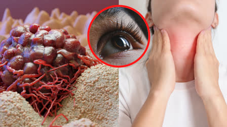 Remove Brain Tumor Through Eyelid