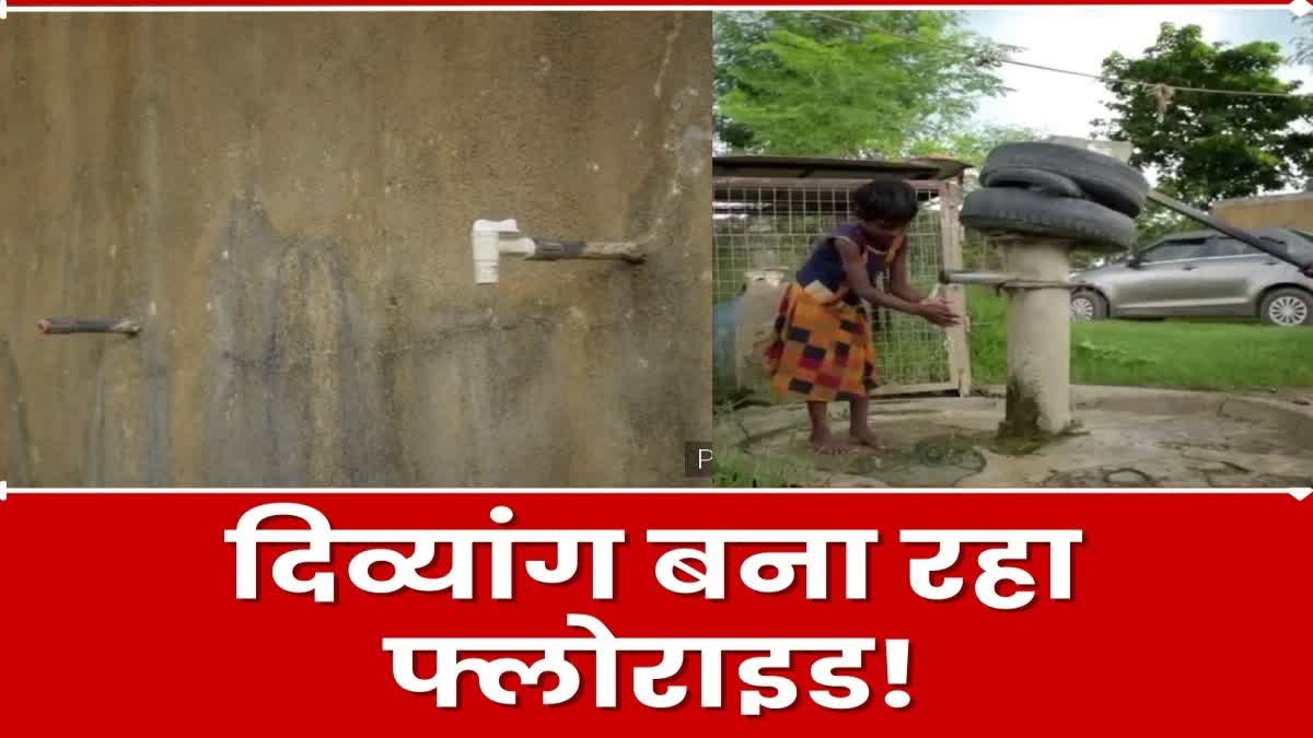 Consumption of calcium tablets increased due to fluoride in water in Palamu