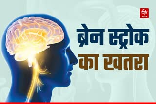 BRAIN STROKE CASES INCREASING IN HIMACHAL