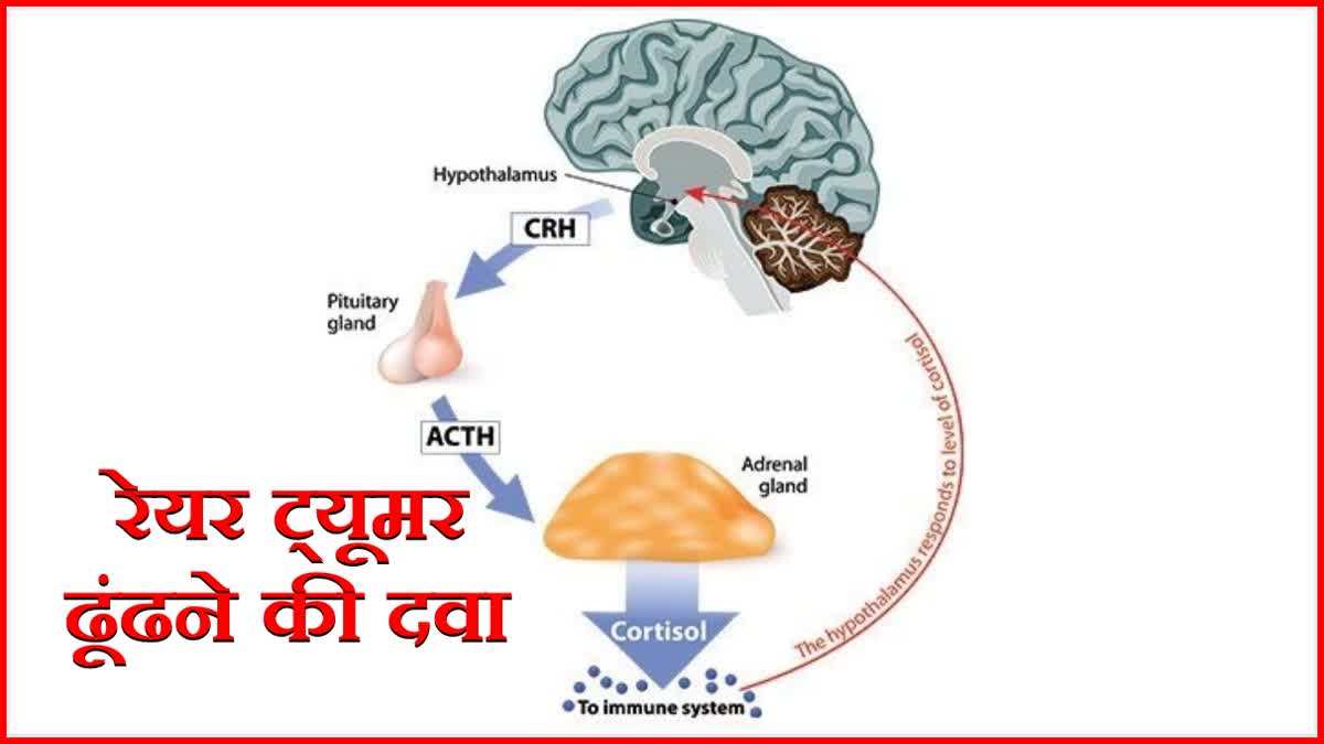 rare tumor treatment in chandigarh pgi