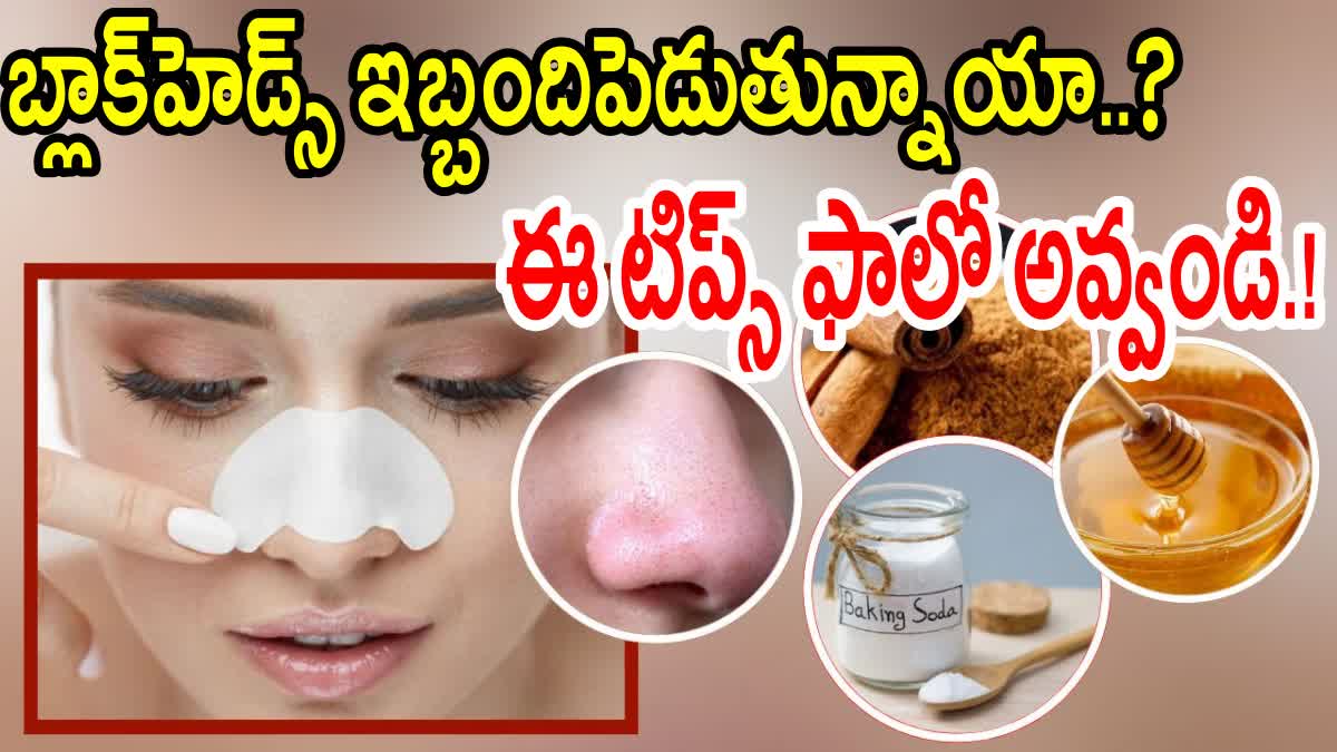 Best_Home_Remedies_to_Avoid_Blackheads