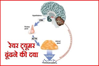 rare tumor treatment in chandigarh pgi