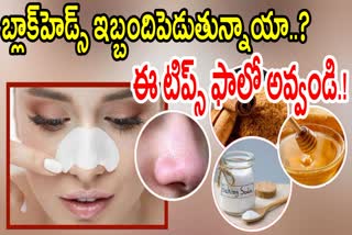 Best_Home_Remedies_to_Avoid_Blackheads