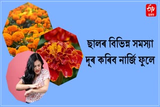How to use marigold flower to treat skin problems